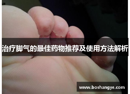 治疗脚气的最佳药物推荐及使用方法解析 治疗脚气的最佳药物推荐及使用方法解析