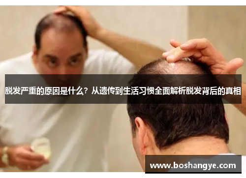脱发严重的原因是什么?从遗传到生活习惯全面解析脱发背后的真相 脱发严重的原因是什么?从遗传到生活习惯全面解析脱发背后的真相
