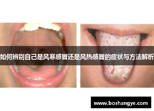 如何辨别自己是风寒感冒还是风热感冒的症状与方法解析